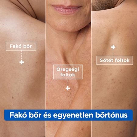 Mixa Niacinamide Bright intenzíven hidratáló krém a sötét foltok ellen