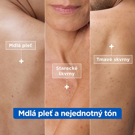 Mixa Niacinamide Bright intenzívne hydratačný krém proti tmavým škvrnám