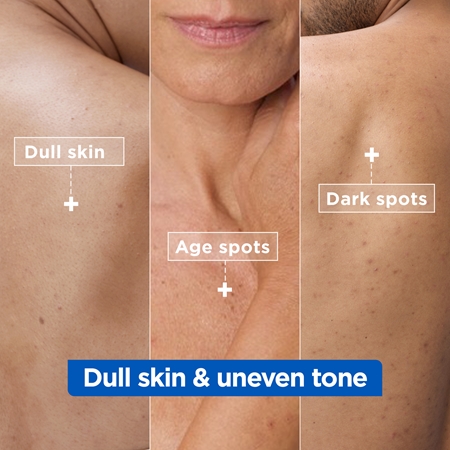 Mixa Niacinamide Bright multifunkcyjny krem krem intensywnie nawilżający przeciw przebarwieniom