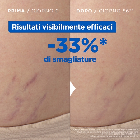 Mixa Stretch Mark Oil olio contro le smagliature