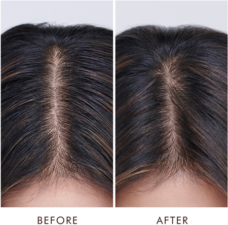 Moroccanoil Treatment Oily Scalp Hair Treatment for oily scalp