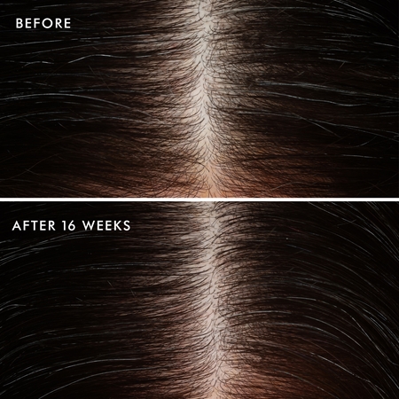 Moroccanoil Scalp Conditioner nyugtató kondicionáló zsíros fejbőrre