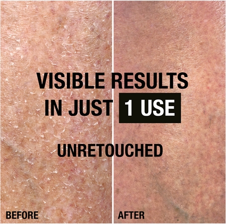 Neutrogena Norská receptura® intenzivně regenerační CICA tělové mléko