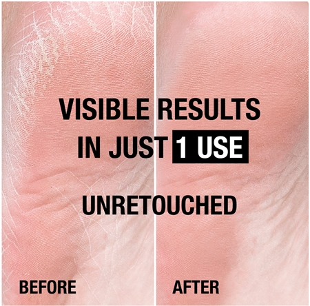 Neutrogena Norská receptura® výživný krém na chodidla