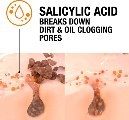 Neutrogena Clear & Defend peeling cu acid salicilic