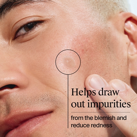 Neutrogena Clear & Defend+ Patches for Problematic Skin