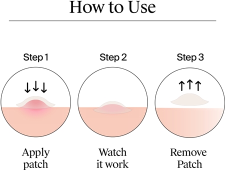 Neutrogena Clear & Defend+ Patches for Problematic Skin