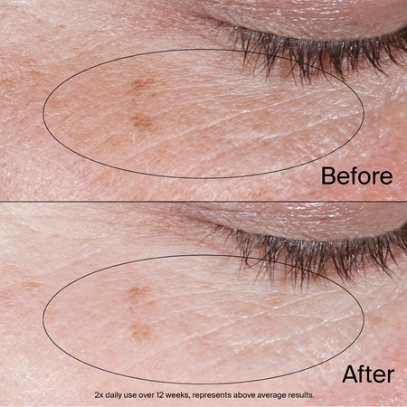 Neutrogena Collagen Bank Eye Gel Cream to treat swelling and dark circles
