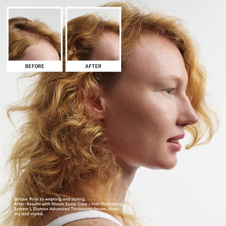 Nioxin System 1 gift set for fine or thinning hair
