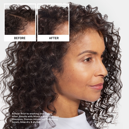 Nioxin Anti-Hair Loss rinkinys nuo plaukų slinkimo