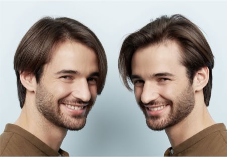 Nioxin 3D Intensive Diaboost θεραπεία για τα μαλλιά για την ενίσχυση της διάμετρου των μαλλιών με άμεσο αποτέλεσμα