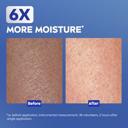 NIVEA Repair & Care Urea crème pour le corps régénérante pour peaux sèches à très sèches