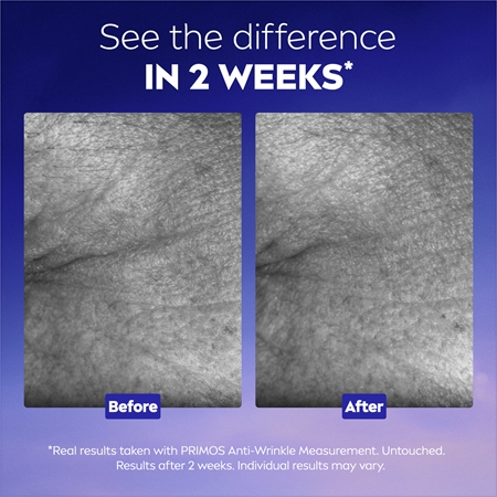 NIVEA Cellular Epigenetics Gift Set for skin rejuvenation