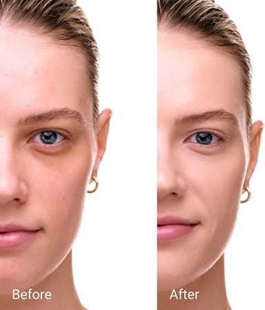 Notino Glow Foundation With SPF 50 & Plant Extracts Illuminating Foundation SPF 50