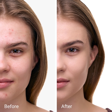 Notino Glow Foundation With SPF 50 & Plant Extracts Illuminating Foundation SPF 50