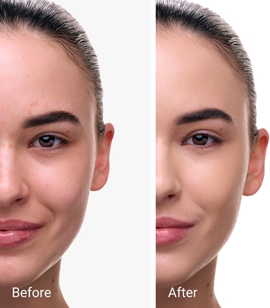 Notino Glow Foundation With SPF 50 & Plant Extracts Illuminating Foundation SPF 50