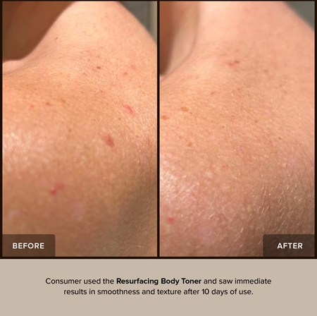Nudestix Nudebody Resurfacing Body Toner smoothing toner for the body