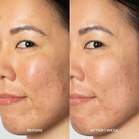 OLEHENRIKSEN Transform Glow 2OH Dark Spot Toner arctonikum a sötét foltok ellen