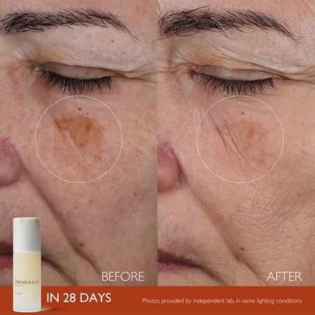 Omorovicza Elixir elixír pre výživu a revitalizáciu pleti