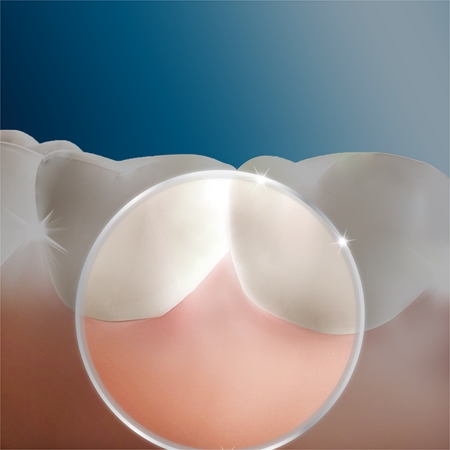 Oral B Oxyjet +3000 Elektrische Zahnbürste und Munddusche 2 in 1