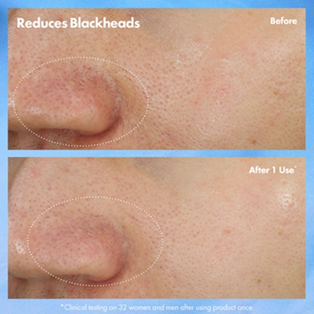 Origins Clear Improvement® Blackhead Clearing Mask-To-Scrub pore cleansing mask for blackheads