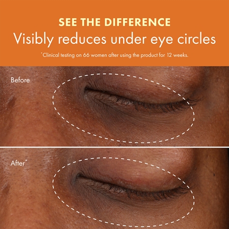 Origins GinZing™ Brightening Eye Cream λαμπρυντική κρέμα ματιών κατά το πρήξιμο και μαύρους κύκλους