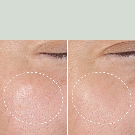 Origins Checks and Balances™ Daily Exfoliating Toner Gentle Exfoliating Tonic