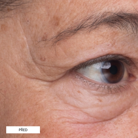 Perricone MD High Potency Growth Factor Eye Serum liftingové oční sérum
