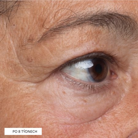 Perricone MD Essential Fx Acyl-Glutathione Eye Serum sérum de olhos com efeito lifting