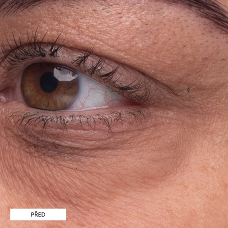 Perricone MD High Potency Growth Factor Eye Serum liftingové oční sérum