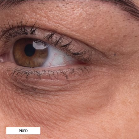 Perricone MD Essential Fx Acyl-Glutathione Eye Serum sérum de olhos com efeito lifting