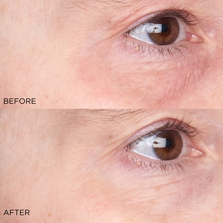 Perricone MD Cold Plasma Plus+ Daily Defense Moisturizer UVA High Protection SPF 35 denní ochranný krém proti stárnutí pleti SPF 35