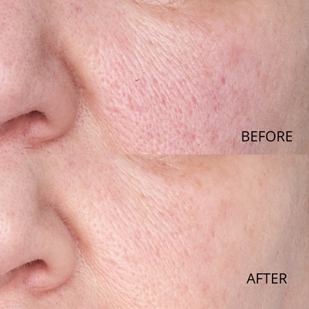 Perricone MD Hypoallergenic Clean Correction Smoothing Restorative Serum vyhlazující sérum pro hydrataci a rozjasnění pleti