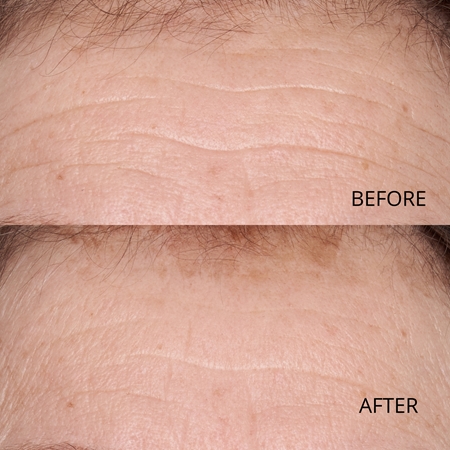 Perricone MD Hypoallergenic Clean Correction Smoothing Restorative Serum vyhlazující sérum pro hydrataci a rozjasnění pleti