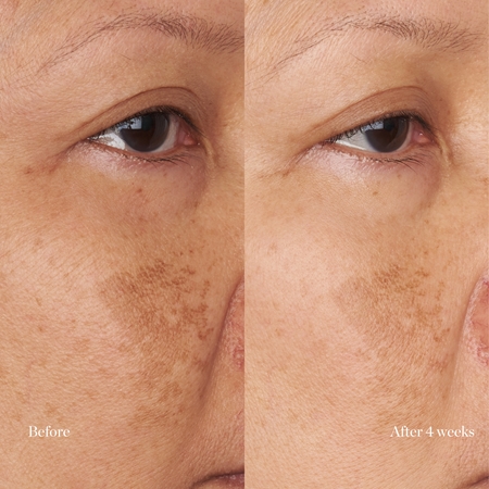 Perricone MD Hypoallergenic Clean Correction Moisturizer creme hidratante e nutritivo