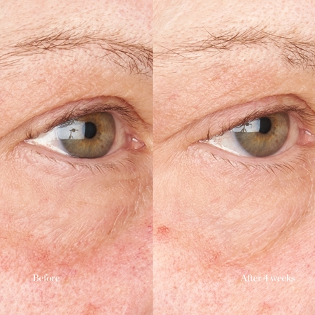 Perricone MD Hypoallergenic Clean Correction Eye Cream hydratačná a rozjasňujúca starostlivosť na očné viečka a kruhy pod očami