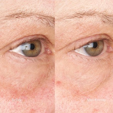 Perricone MD Hypoallergenic Clean Correction Eye Cream Mitrinošs un izgaismojošs līdzeklis acu plakstiņiem un tumšajiem lokiem