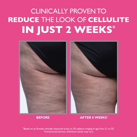 Peter Thomas Roth FIRMx Tight & Toned crème pour le corps raffermissante anti-cellulite