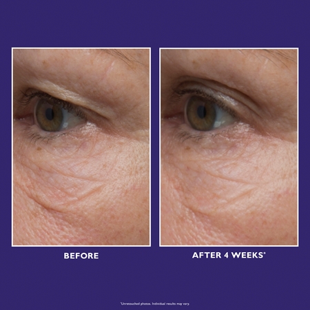 Peter Thomas Roth Ultimate Solution 5 Multitasking Eye Cream creme rico hidratante para olhos