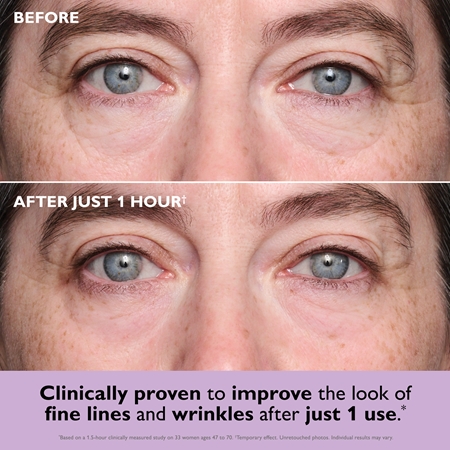 Peter Thomas Roth Instant FIRMx Collagen Infusion Tighteneing Eye Patches συσφικτικά τζελ μαξιλαράκια κάτω από τα μάτια