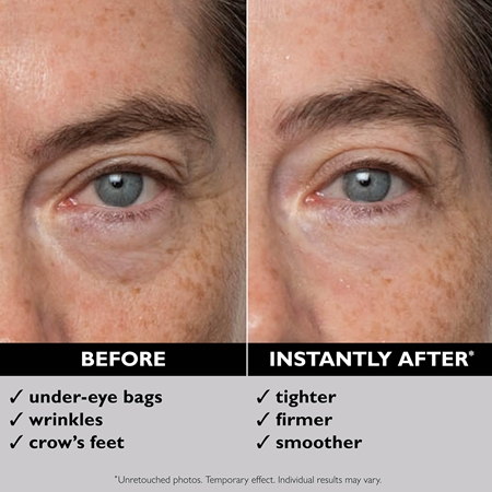 Peter Thomas Roth FIRMx® Eye Duo Set Gift Set to treat eye wrinkles