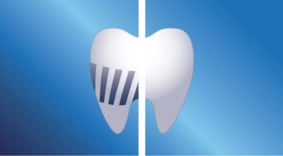 Philips Sonicare AirFloss Ultra Interdental-Düsen