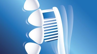 Philips Sonicare FlexCare Platinum HX9112/12 cepillo de dientes eléctrico sónico con 3 programas de cepillado