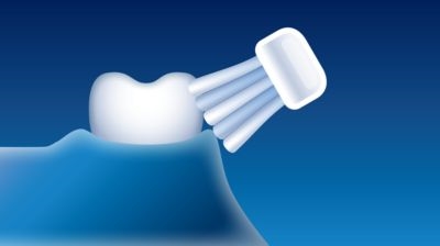 Philips Sonicare EasyClean HX6511/50 cepillo de dientes eléctrico sónico