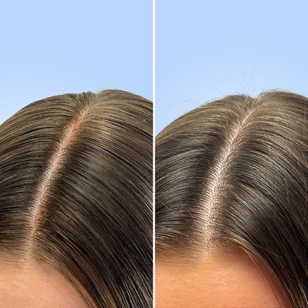 Q+A Clarifying Deep Cleanse Clarifying Shampoo