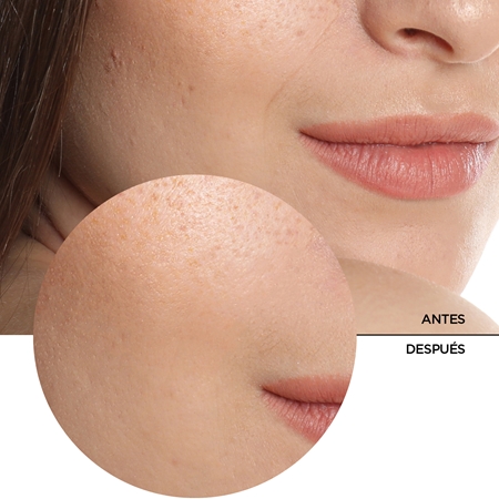 Revox B77 JUST Hyaluronic Acid 5% loción hidratante para rostro y cuello