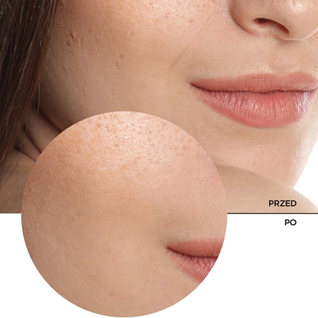 Revox B77 Just Hyaluronic Acid 5% fluid nawilżający do twarzy i szyi