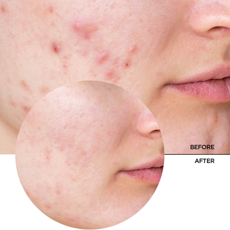 Revox B77 Just Niacinamide 10% Niisutav seerum
