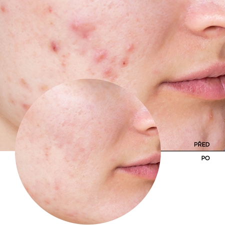 Revox B77 JUST Niacinamide 10% hydratační sérum