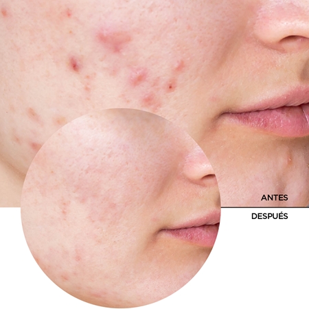 Revox B77 JUST Niacinamide 10% sérum hidratante